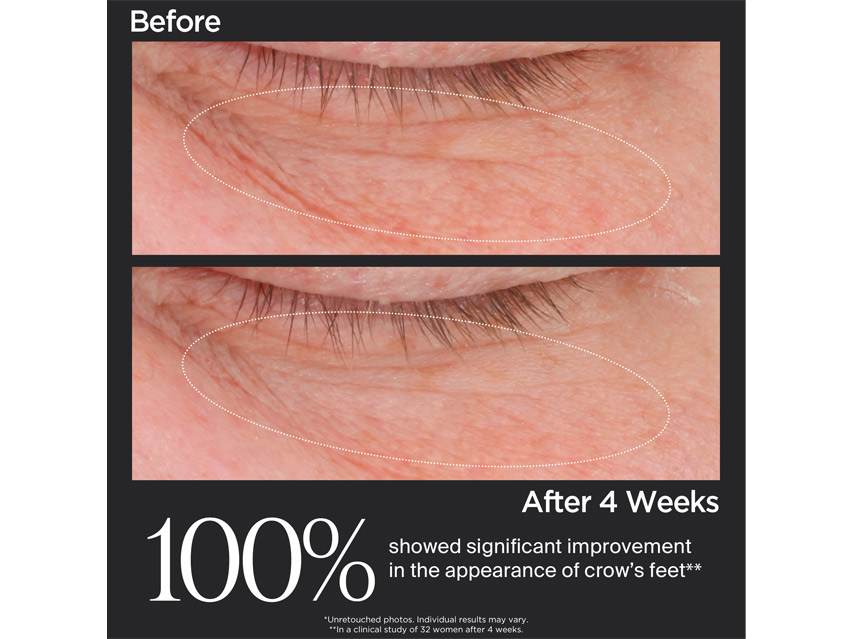 Perricone MD Cold Plasma Plus+ Eye Advanced Eye Cream