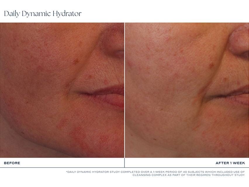 iS CLINICAL Daily Dynamic Hydrator