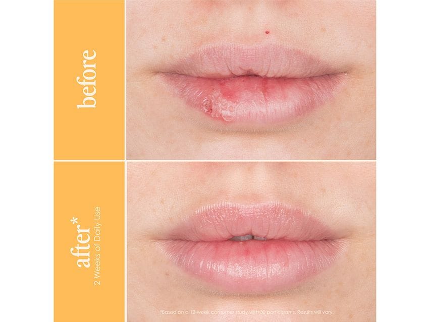 GrandeLash-MD GrandePOUT Plumping Lip Mask