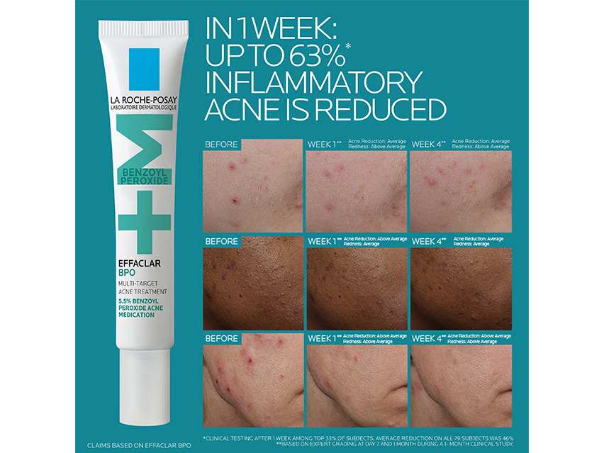 La Roche-Posay Effaclar Stubborn Acne Kit