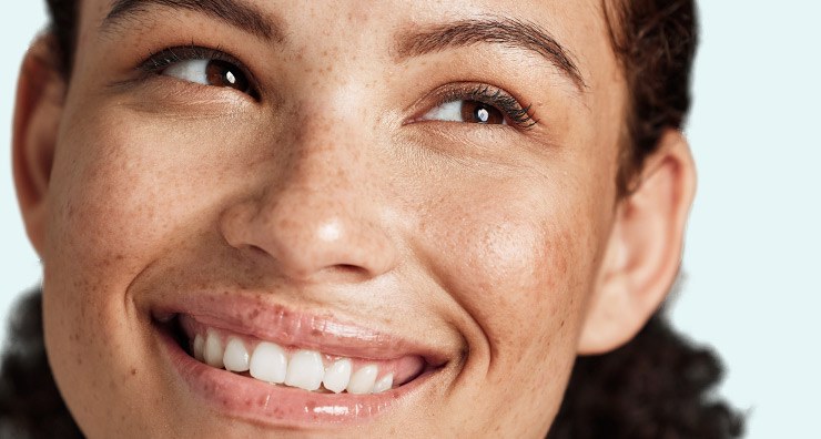 Model with healthy, natural skin smiling