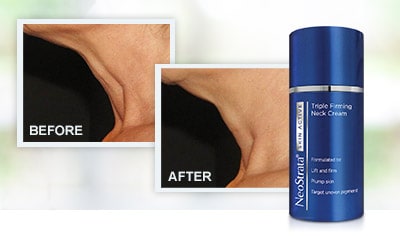 Transformation Tuesday: NeoStrata Skin Active Triple Firming Neck Cream