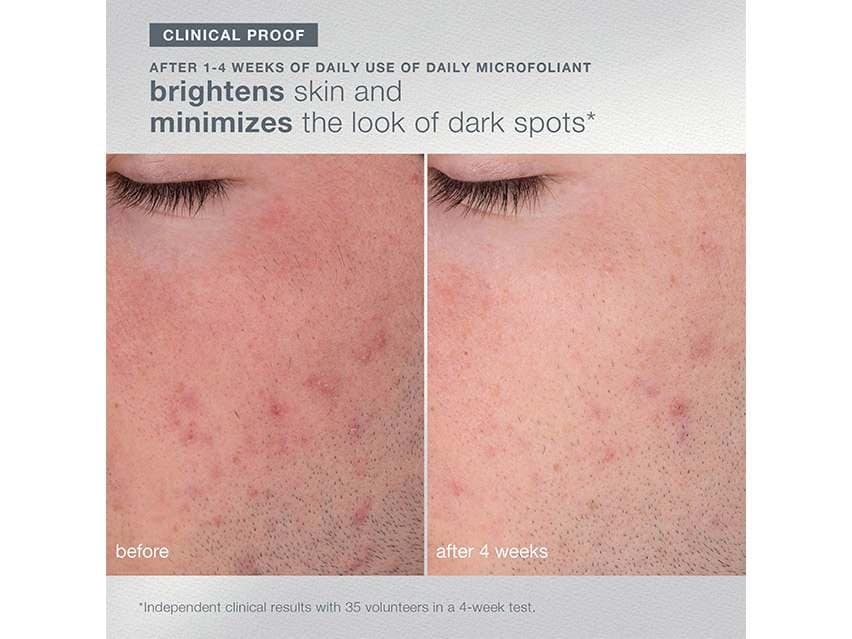 Dermalogica Home for the Holidays Set - Limited Edition