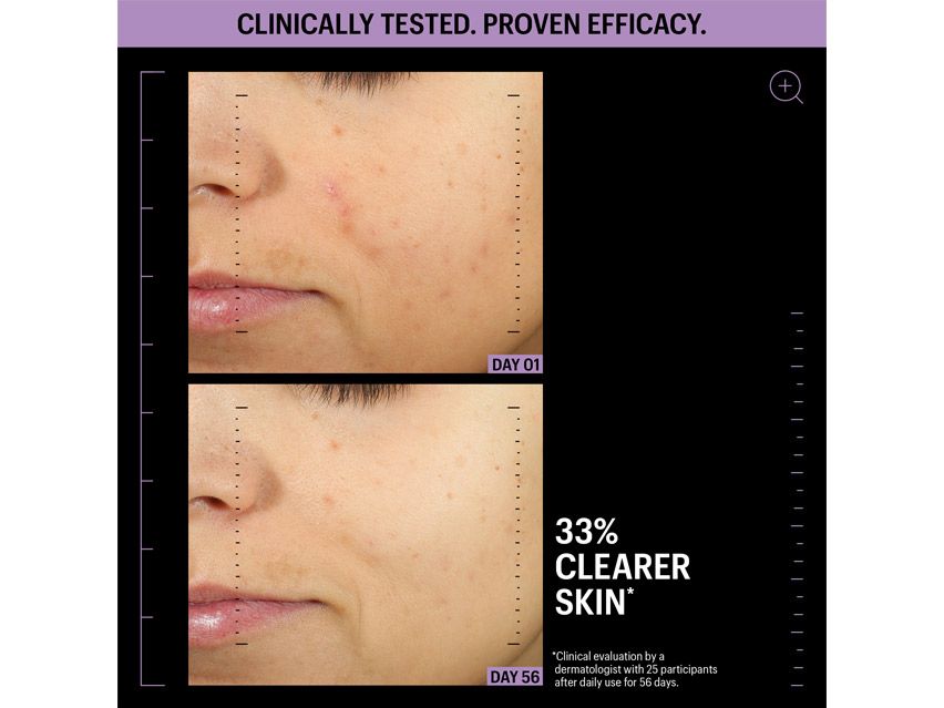 Allies of Skin Azelaic &amp; Kojic Advanced Clarifying Serum