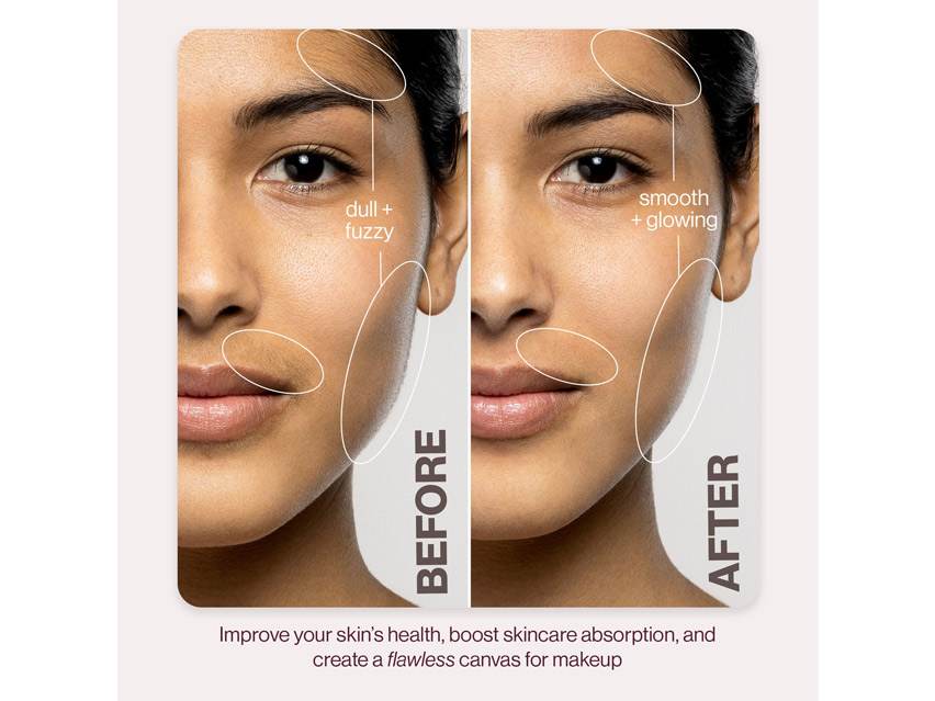DERMAFLASH LUXE+ Anti-Aging, Exfoliation + Peach Fuzz Removal Set