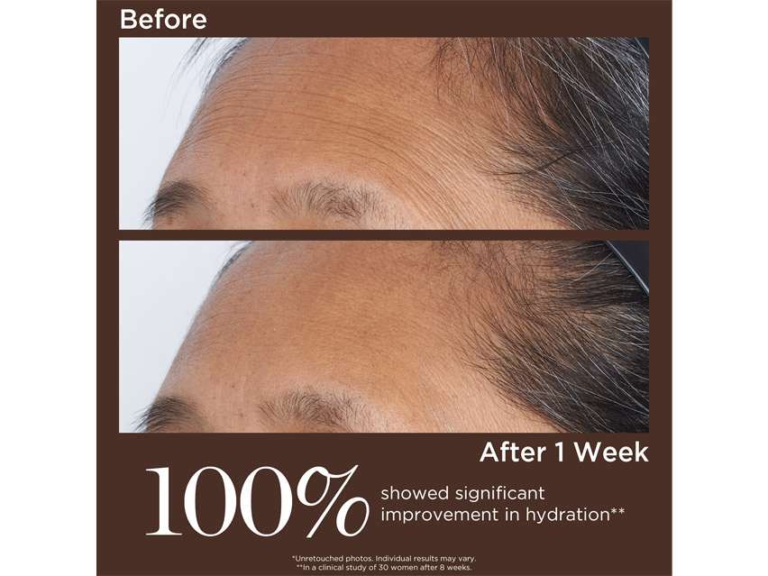 Perricone MD High Potency Retinol Recovery Overnight Moisturizer