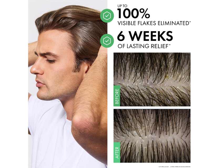 Vichy Dercos Selenium Sulfide Anti-Dandruff Shampoo