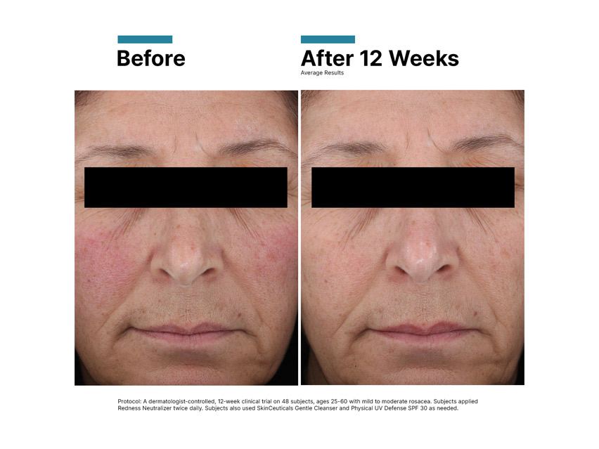 SkinCeuticals Redness Neutralizer Lotion