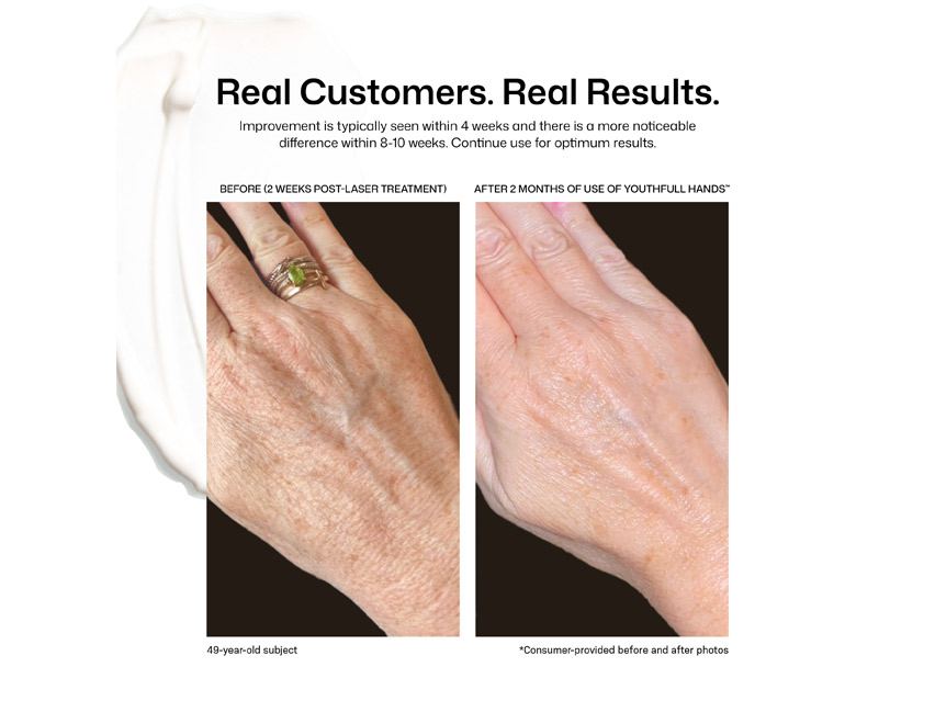 Revision Skincare YouthFull Hands