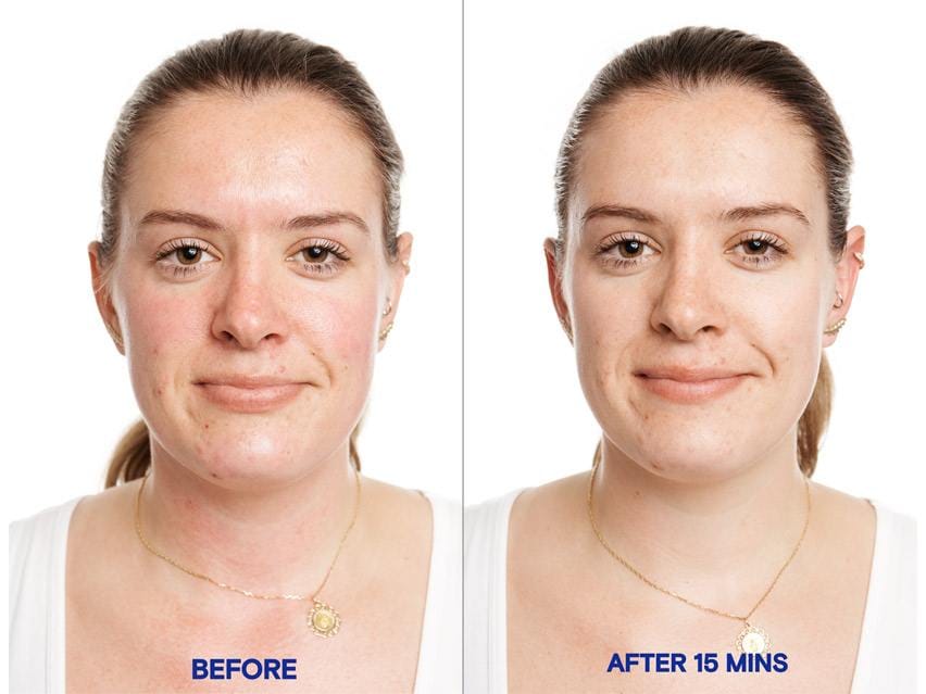 KORRES Greek Yoghurt Probiotic SuperDose Face Mask