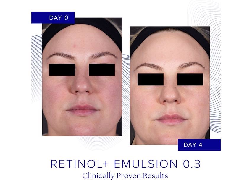 iS CLINICAL Retinol+ Emulsion 0.3 Cream