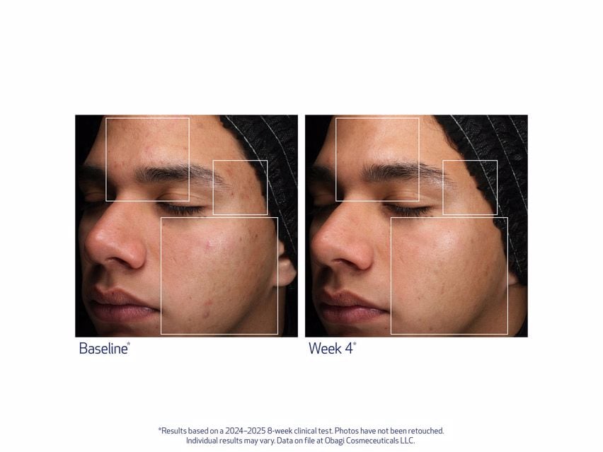 Obagi Retinol + PHA Refining Night Cream