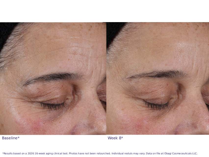 Obagi Professional-C 20% Vitamin C Antioxidant Serum