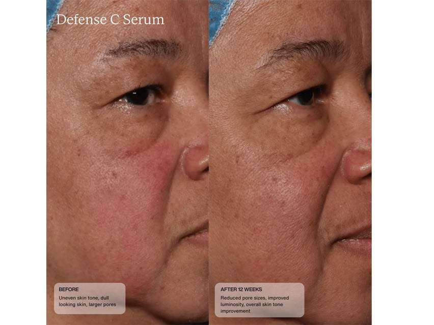Sent&#233; Defense C Serum with HSA