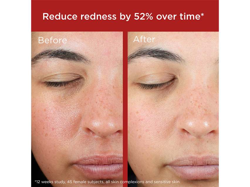 EltaMD UV Skin Recovery Broad Spectrum SPF 50 - Green Tint for Redness