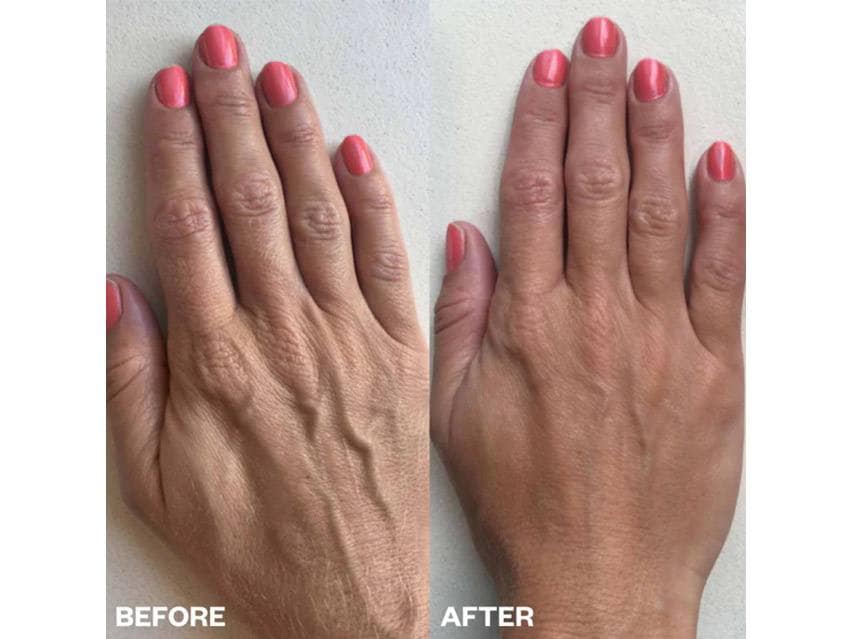 Wrinkles Schminkles Hand Wrinkle Smoothing Patches