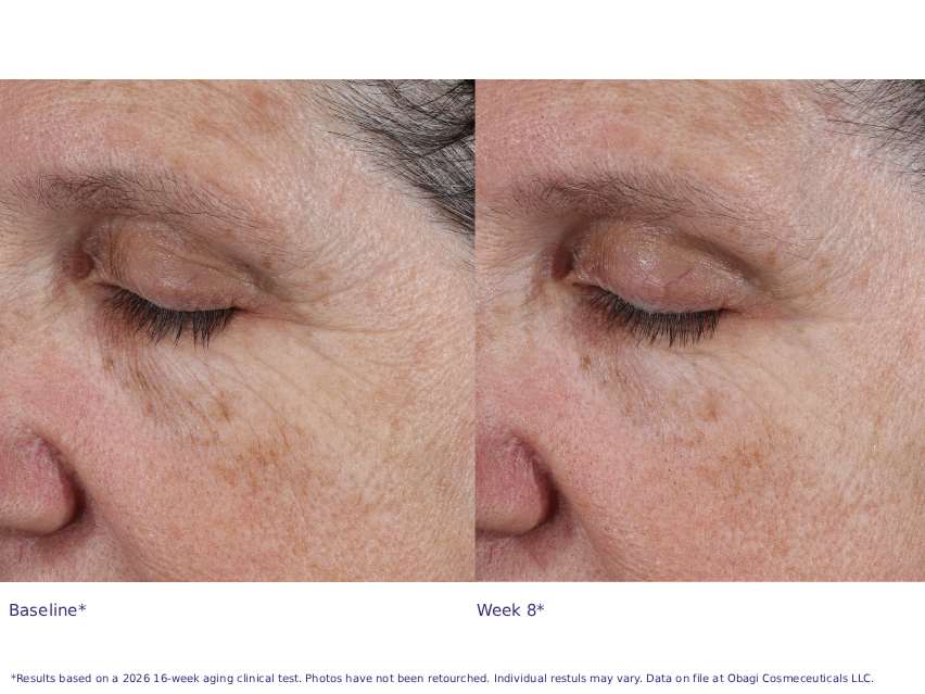 Obagi Professional-C 20% Vitamin C Antioxidant Serum