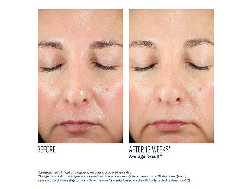 skinbetter science BioRewind Skin Health Dietary Supplement