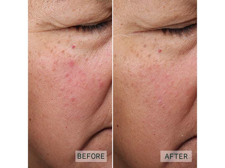 Aramore NAD+ Cell Restoration Cream