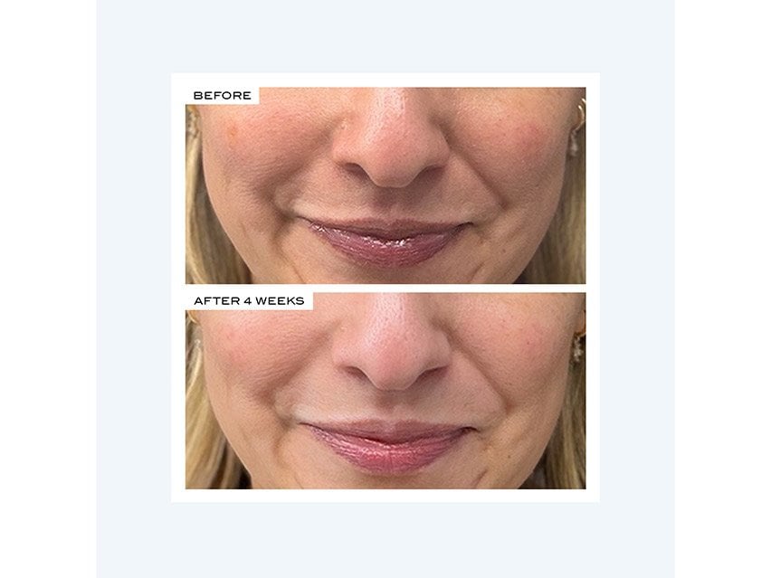 111SKIN Precision Peel