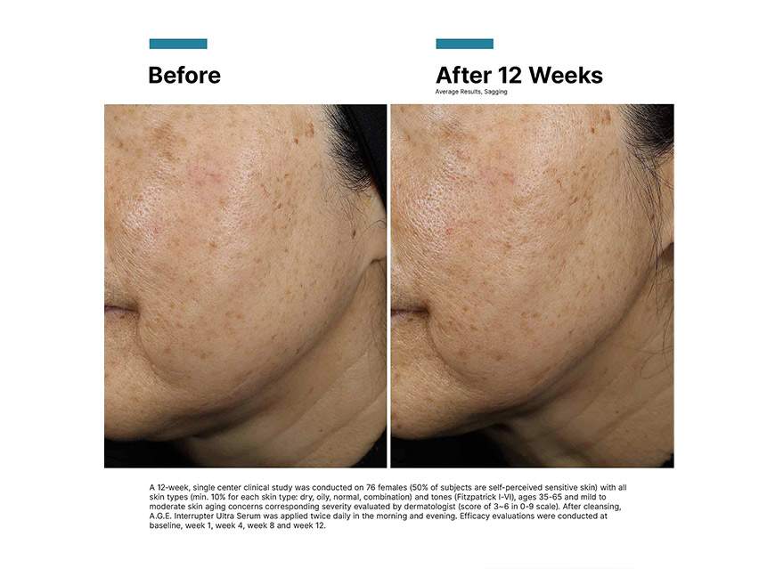 SkinCeuticals A.G.E. Interrupter Ultra Serum