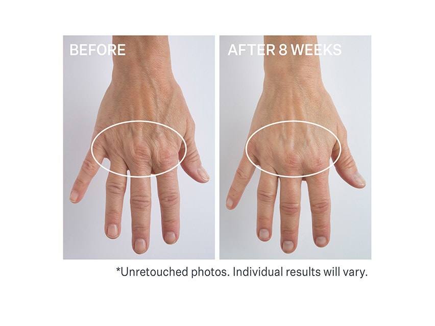 StriVectin Anti-Wrinkle Volumizing & Rejuvenating Hand Cream