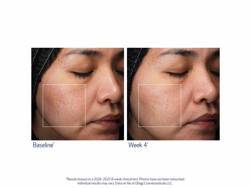 Obagi Retinol + PHA Refining Night Cream