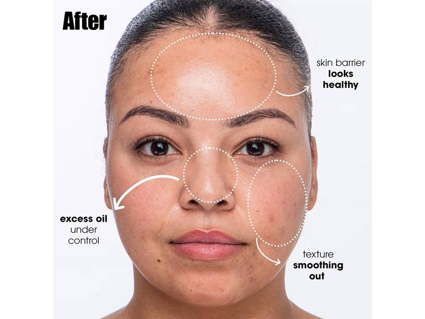 Sunday Riley Breakout Breakup Purifying Salicylic Acid Cleanser