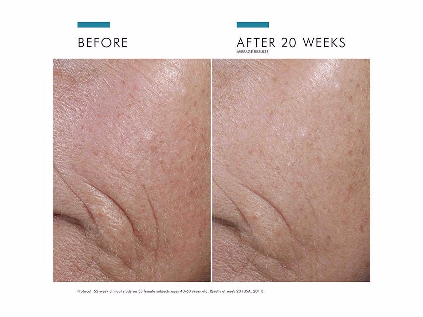 SkinCeuticals C E Ferulic Antioxidant Serum Before and After Photos