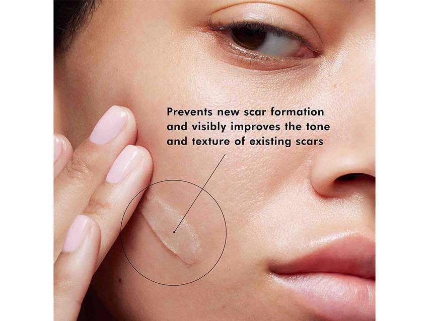 scar skin texture