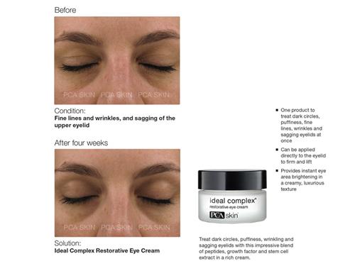 pca eye cream
