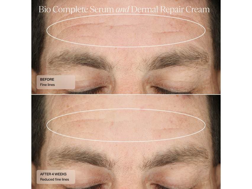 Sent&#233; Dermal Repair Cream &amp; Bio Complete Serum Duo - $203 Value!