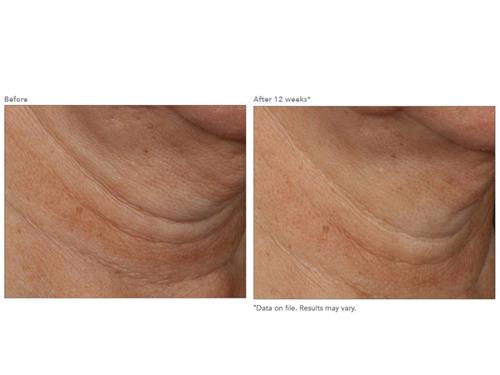 revision skincare nectifirm advanced