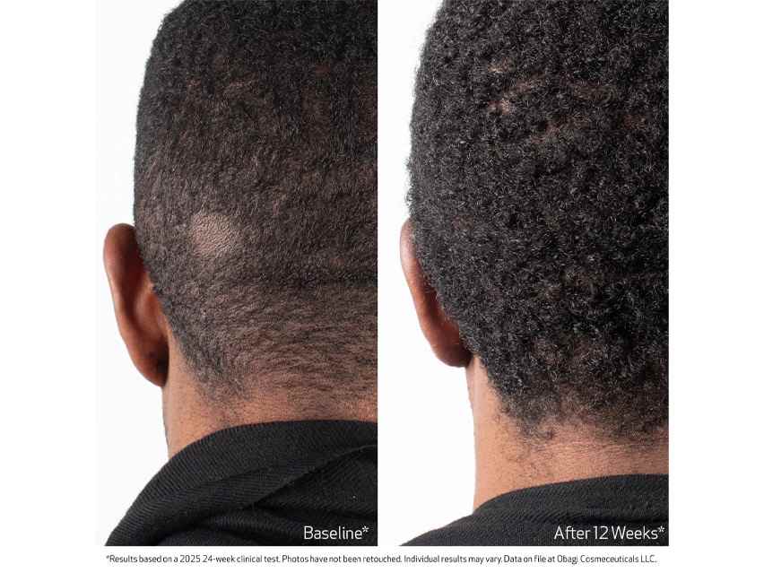 Obagi Nu-Cil™ BioStim Scalp Serum