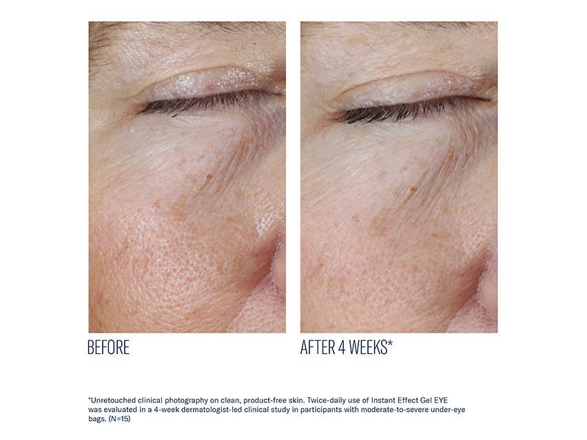 skinbetter science Instant Effect Gel EYE