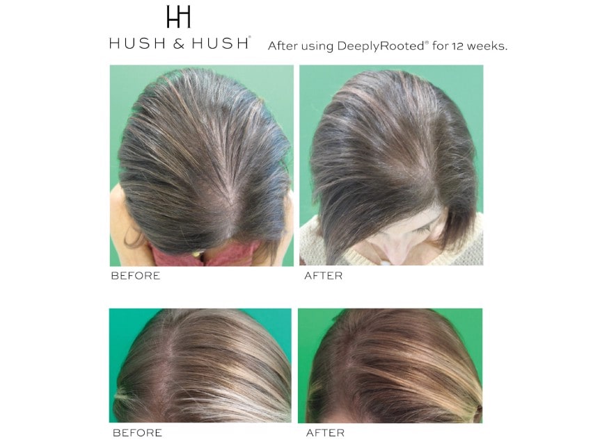 Hush & Hush DeeplyRooted Dietary Supplement