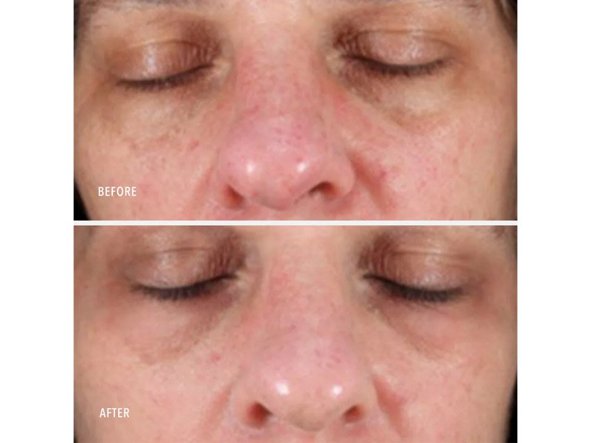 HydroPeptide Collagen ReActivate PM