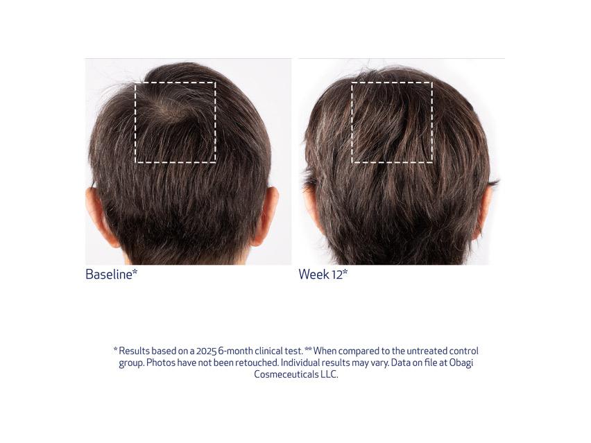 Obagi Nu-Cil BioStim Scalp Serum