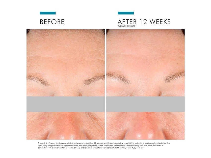 SkinCeuticals A.G.E. Interrupter Advanced Corrective Cream Before and After
