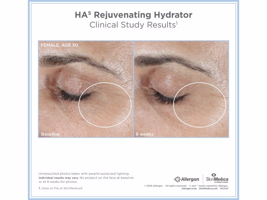 SkinMedica HA5 Rejuvenating Hydrator before and after results for women
