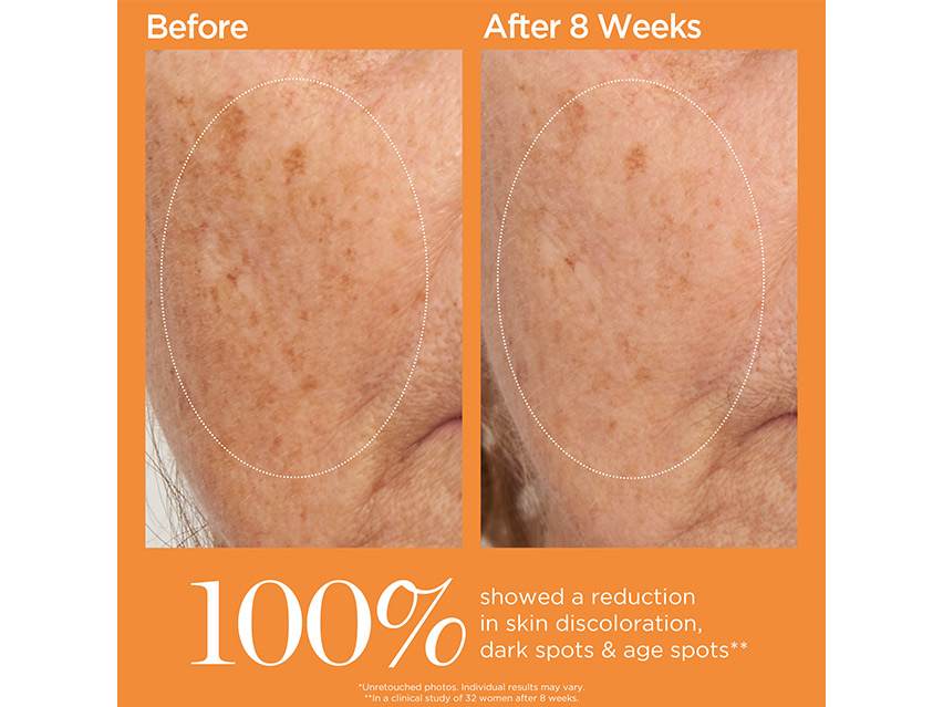 Perricone MD Vitamin Ester 20% Dark Spot Corrective Serum