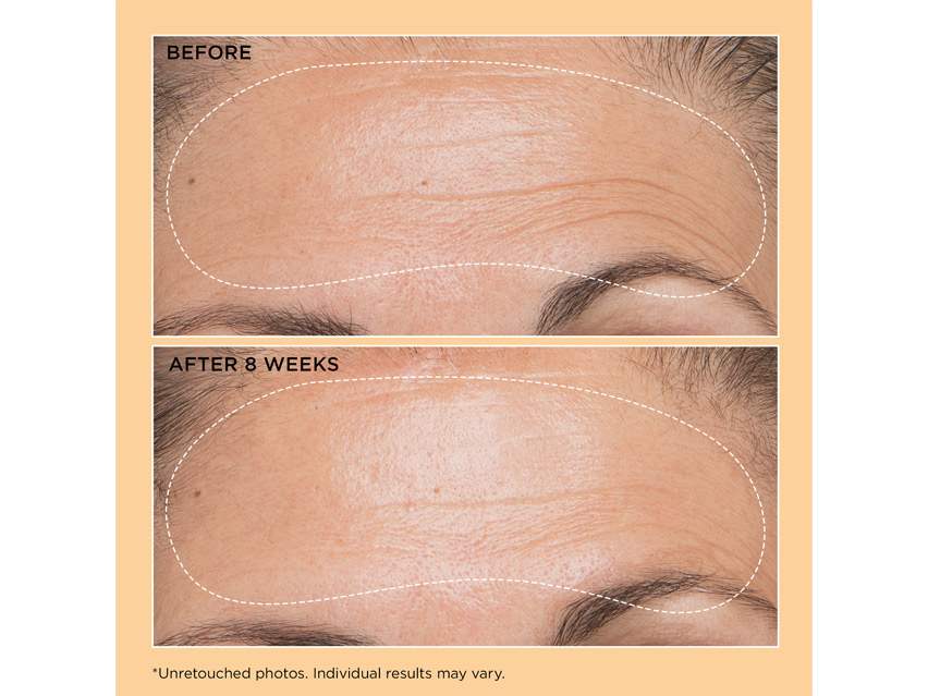 Perricone MD Neuropeptide Dr. Perricone's Liquid Gold Firming Facial Concentrate