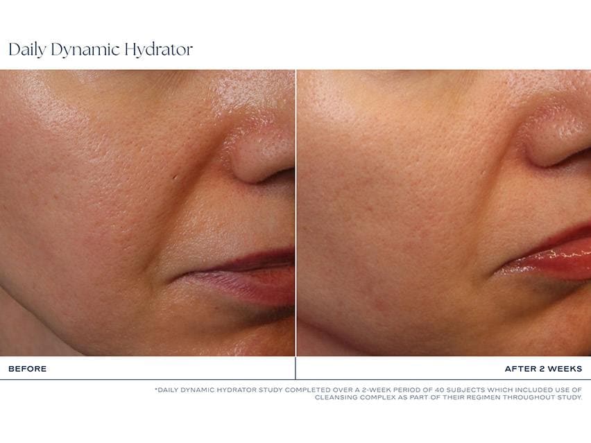 iS CLINICAL Daily Dynamic Hydrator