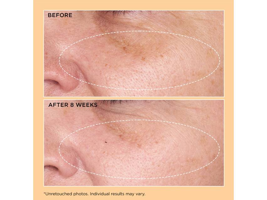 Perricone MD Neuropeptide Rejuvenating Moisturizer Broad Spectrum SPF 25