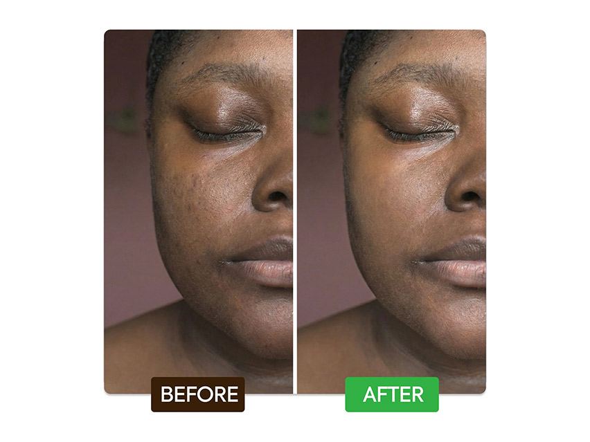 Makari Kojic &amp; Azelaic Brightening Serum