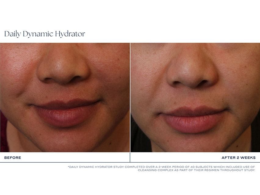 iS CLINICAL Daily Dynamic Hydrator