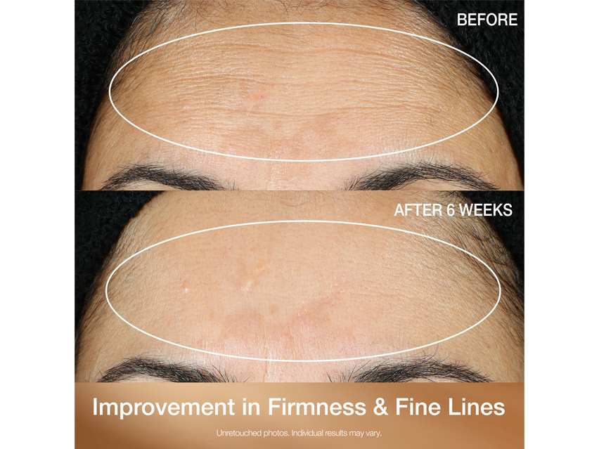 StriVectin Multi-Action Super-C Retinol Brighten &amp; Correct Vitamin C Serum