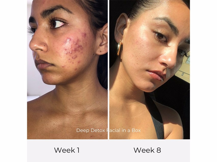 Olga Lorencin Skin Care Deep Detox Facial in a Box