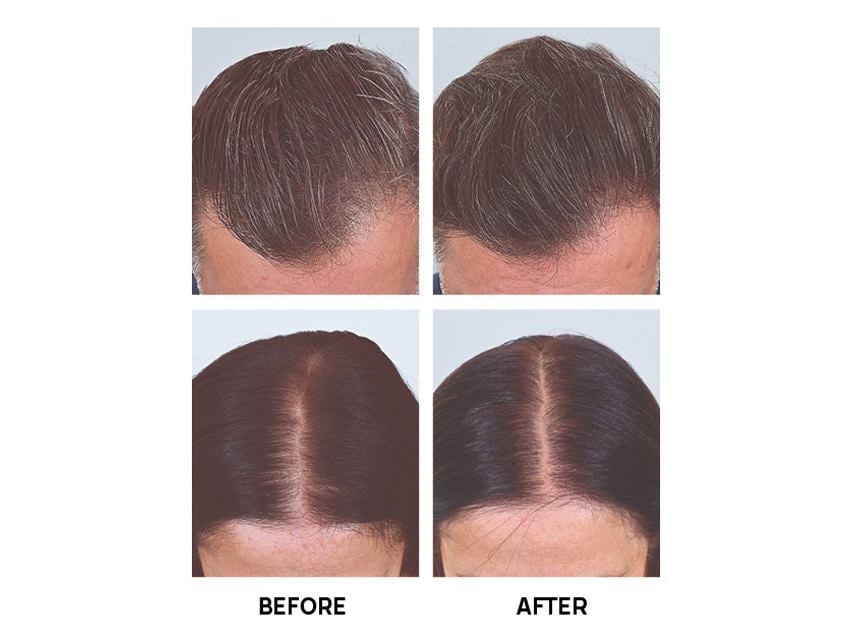 Rene Furterer Triphasic Progressive Hair Thickening Scalp Serum