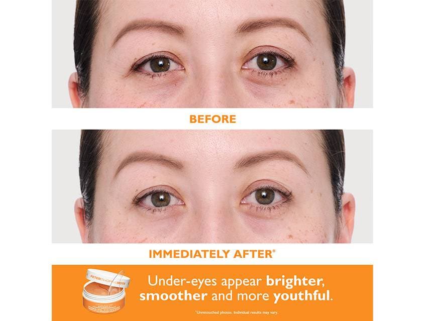 Peter Thomas Roth Vitamin C &amp; Hyaluronic Eye Patch Set - Limited Edition